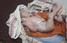 नाले में फेक हुआ कपड़े में लपेटा नवजात शिशु मिला